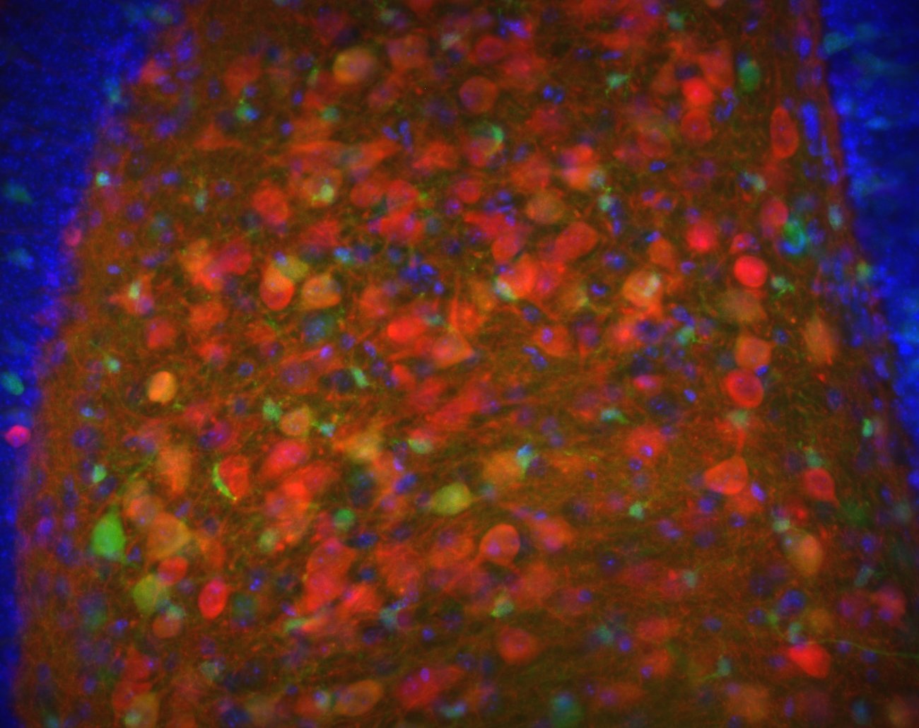 Giro denteado, a dobra do hipocampo onde nascem os neurônios novos